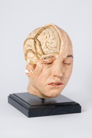 Model of the head of an adult male, brain exposed on the right-hand side