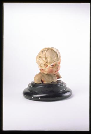 model head of seven month-old foetus