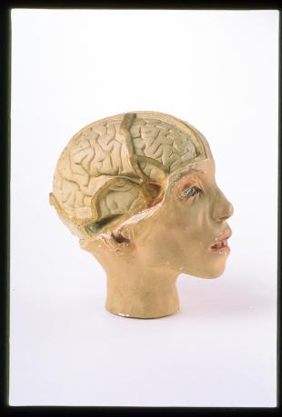 Model of the head of a young girl, brain exposed on the righthand side